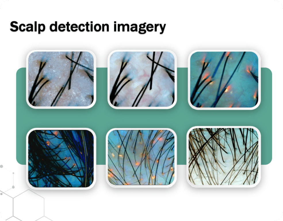 SK-X5-Pro scalp detection imagery under multiple analysis modes